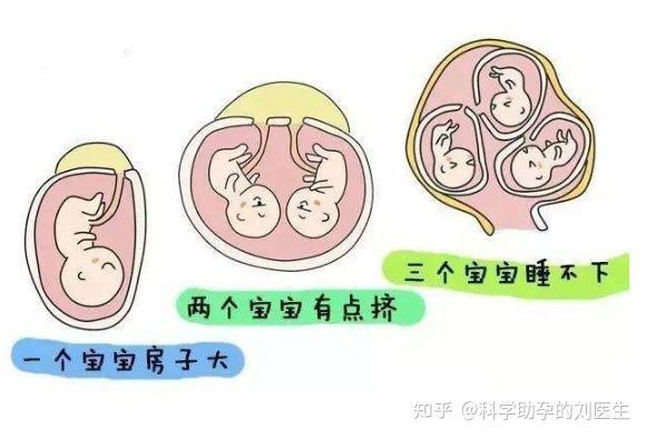 孕妇贫血